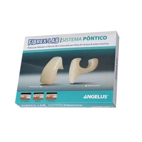 Pivoti Fibrex Lab Pontic System Kit Angelus