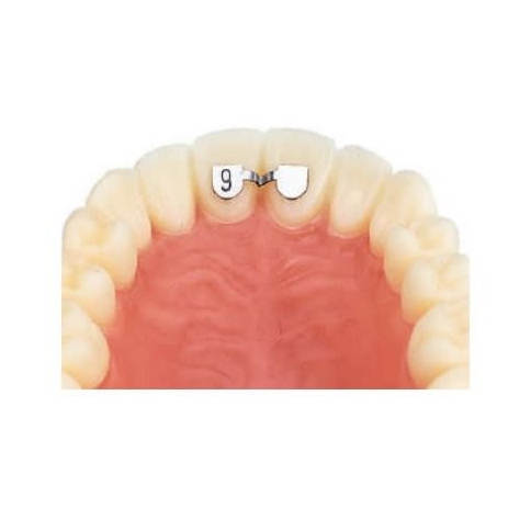 KIT D.B. RETAINERS - SUPERIOR - 20buc