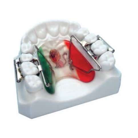 Kit dispozitiv distalizare rapida molar First-Class