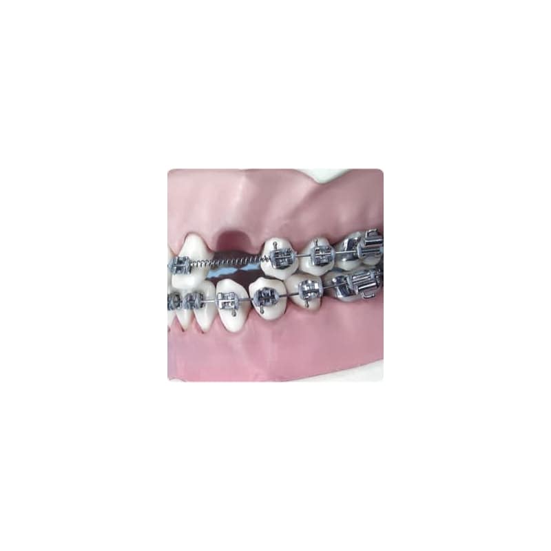 Arc deschis Coil Spring pt extraoral .045/010 lip bumper 2 buc.