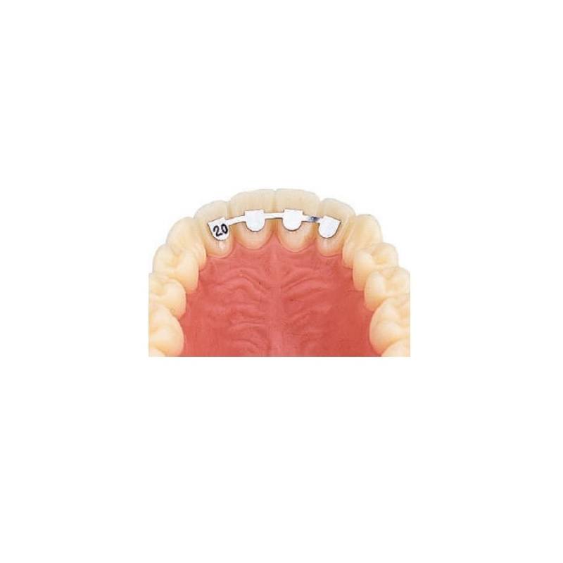 D.B. RETAINERS - UPPER LAT/LAT 14mm - 10buc