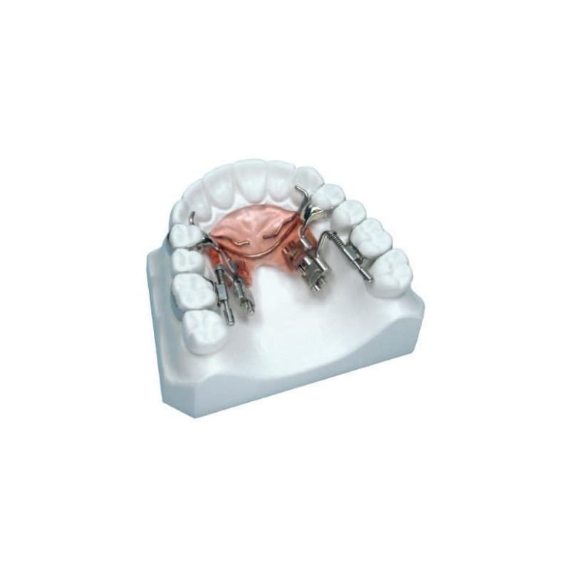 Kit dispozitiv distalizare molari superiori Fast Back Leone