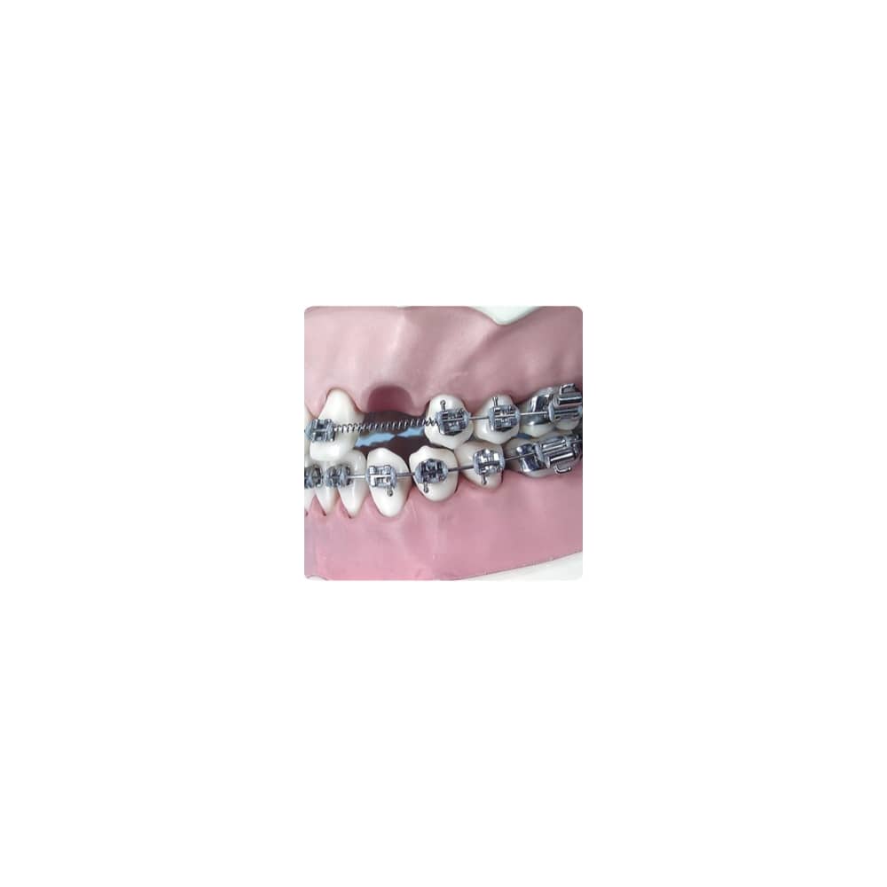 Arc deschis Coil Spring pt extraoral .055/014  lip bumper 2 buc.