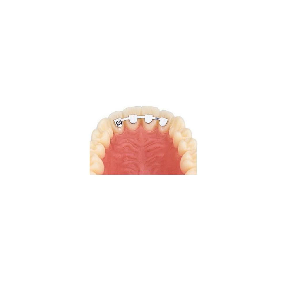 D.B. RETAINERS - UPPER LAT/LAT 14mm - 10buc